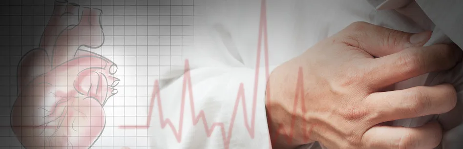 Heart attack in young and middle-aged professionals.